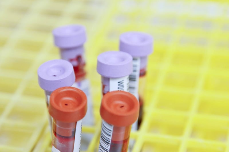 AMH level tests for egg donors.